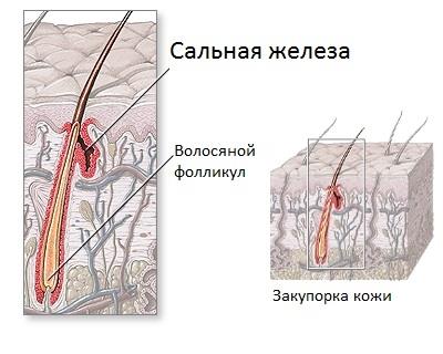 Как и чем лечить заеды в уголках рта быстро Как и чем лечить заеды в уголках рта быстро
