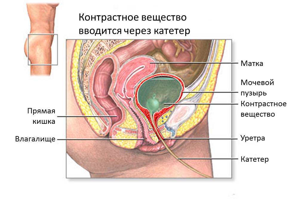 Где Находится Мочевой У Человека Фото