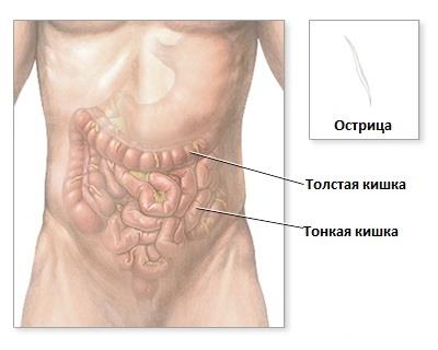 Острицы Под Микроскопом Фото