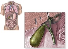 Обструкции протоков поджелудочной железы или общего желчного протока