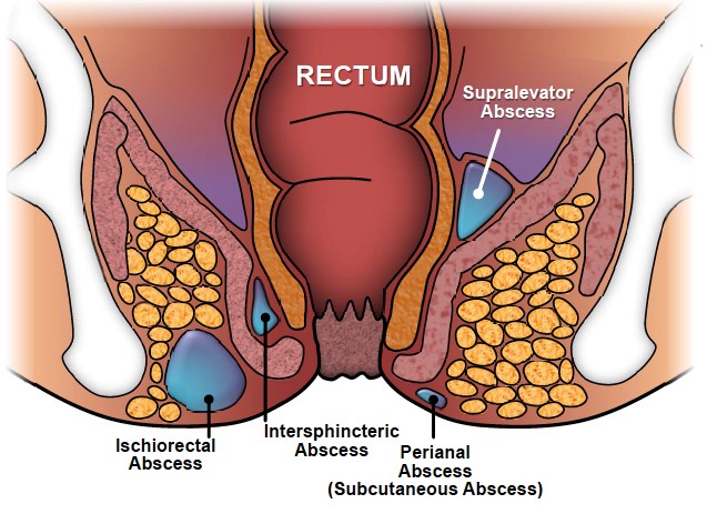 Rectum diagram