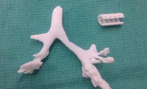 Технология 3D-печати впервые спасла жизнь человека