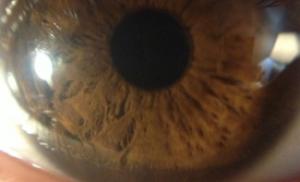 Казахскому научно-исследовательскому институту глазных болезней исполнилось 80 лет
