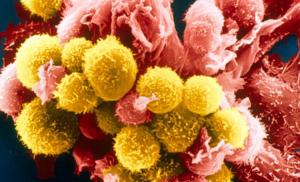 Онкологи обнаружили особый белок, который может помочь приостановить метастазы рака